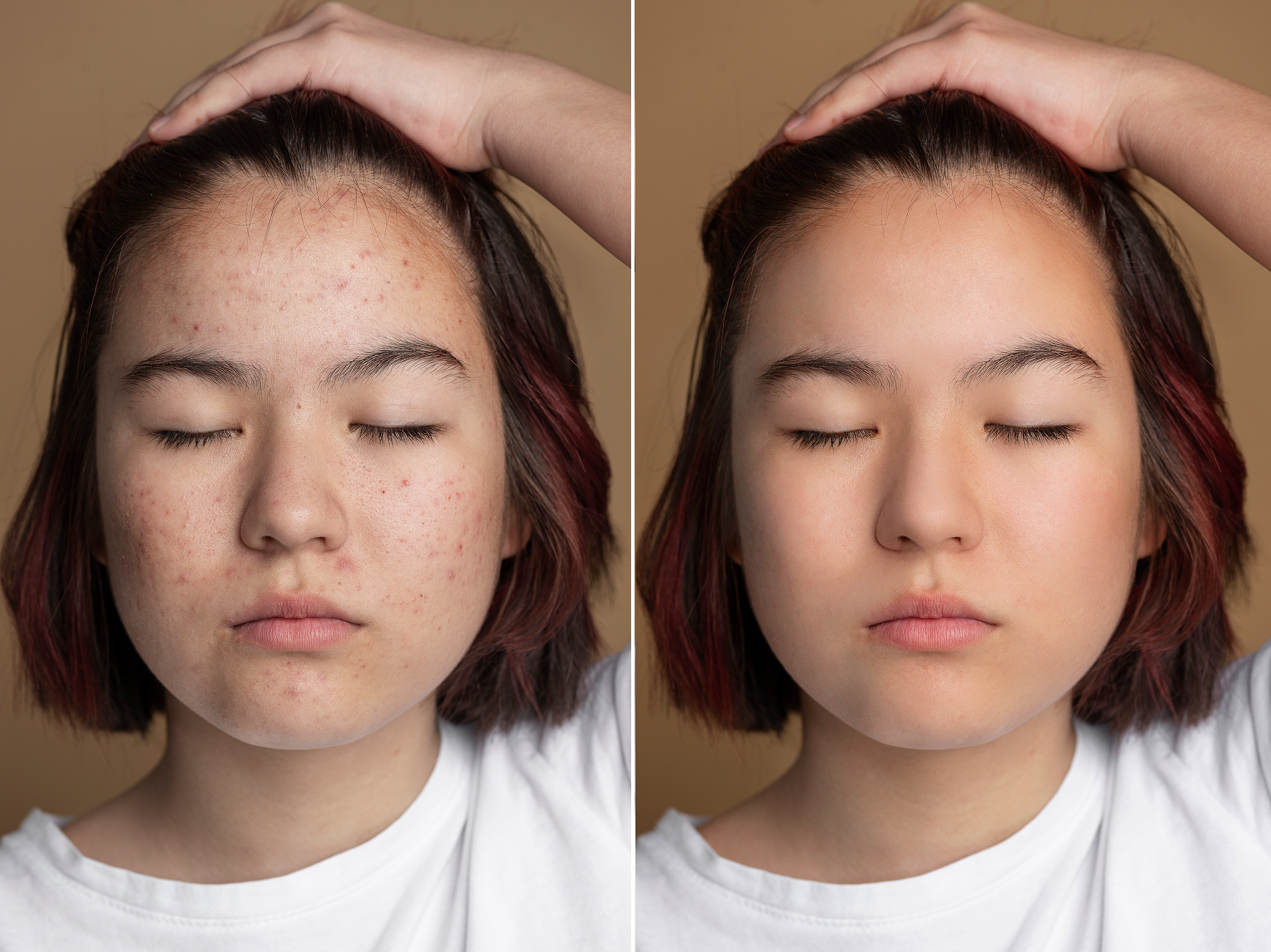 Professional Skin Retouching Service – High-End Portrait Editing
